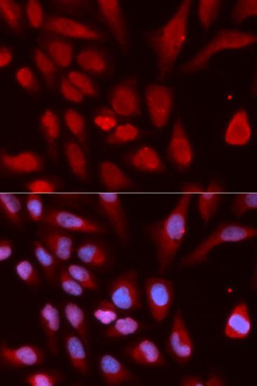 Immunofluorescence - UHRF1 antibody (144-02343)