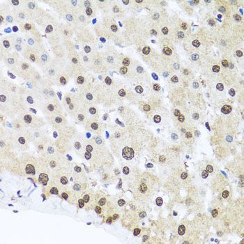 Immunohistochemistry - FUBP1 Polyclonal Antibody (144-05587)
