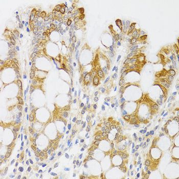 Immunohistochemistry - MYO5A antibody (144-09830)