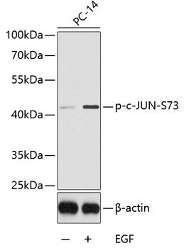 Western blot