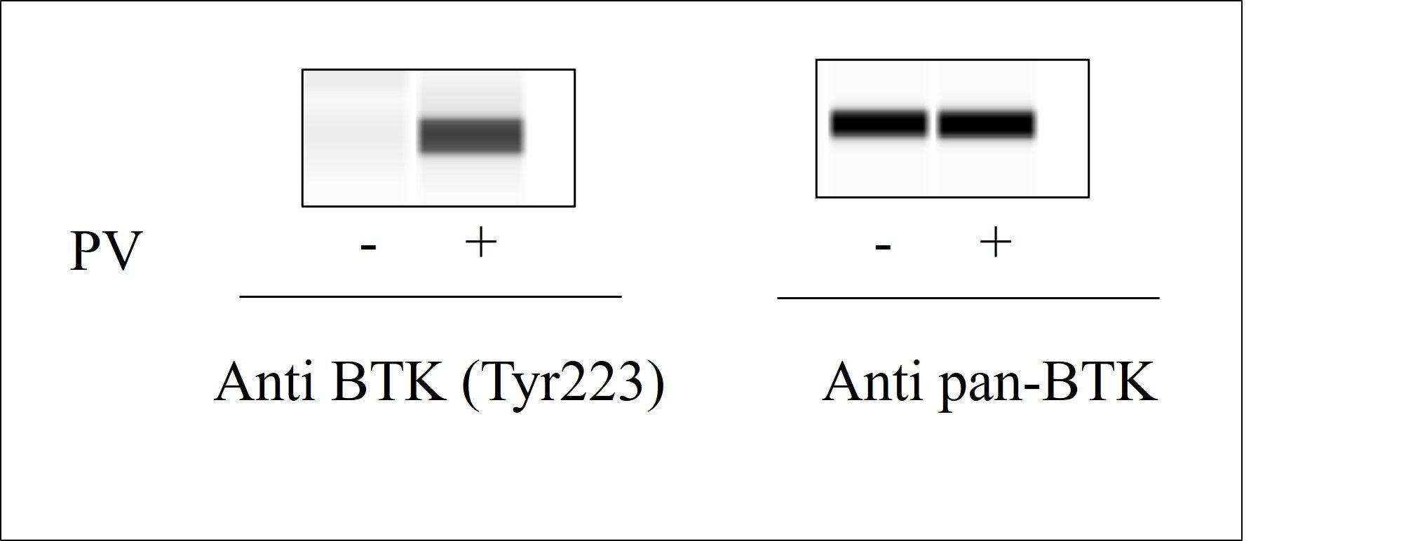 BTK (Y223) - Western Blot
