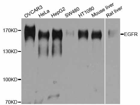 Western blot - EGFR Polyclonal Antibody (144-011577)