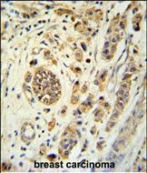 IHC-P