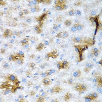 Immunohistochemistry - NCL Polyclonal Antibody (144-05904)