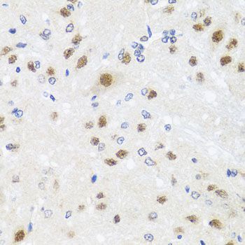 Immunohistochemistry - CETN3 antibody (144-08111)