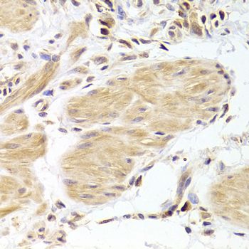 Immunohistochemistry - CASP2 Antibody (144-05724)