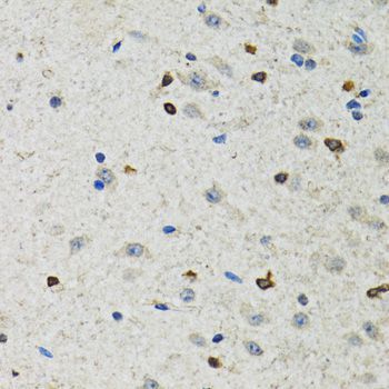 Immunohistochemistry - BHLHE40 Polyclonal Antibody (144-06534)