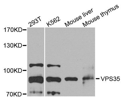 Western blot - VPS35 antibody (144-07117)