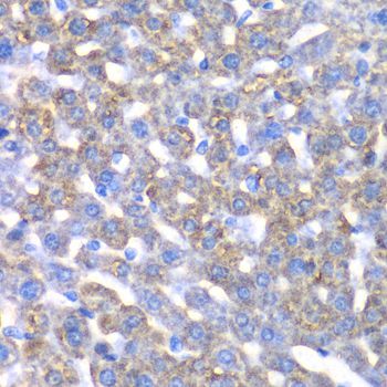 Immunohistochemistry - CCBL1 Polyclonal Antibody (144-06542)