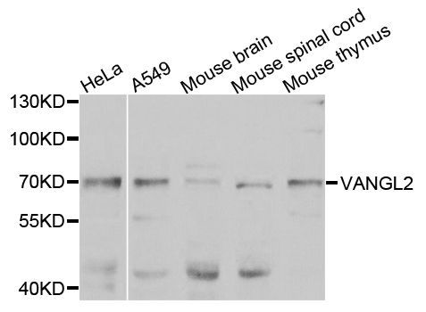 Western blot - VANGL2 antibody (144-07825)