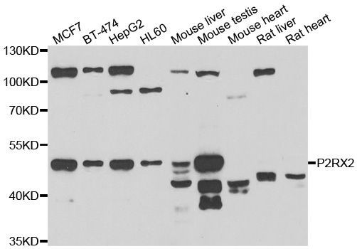 Western blot - P2RX2 antibody (144-07078)