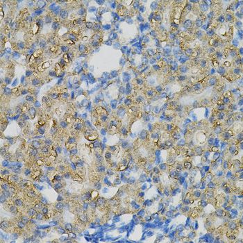 Immunohistochemistry - INPP5J Polyclonal Antibody (144-06631)