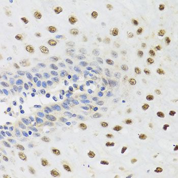Immunohistochemistry - YTHDF3 antibody (144-08395)