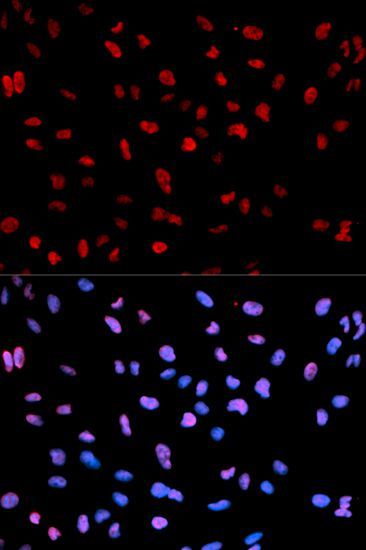 Immunofluorescence - Phospho-MEF2C-S396 antibody (144-50075)