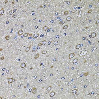 Immunohistochemistry - PTCD3 Polyclonal Antibody (144-08497)