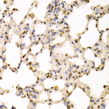 Immunohistochemistry - SFN Polyclonal Antibody (144-01026)