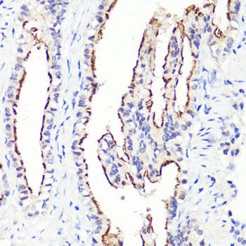 Immunohistochemistry - CD44 Polyclonal Antibody (144-00340)