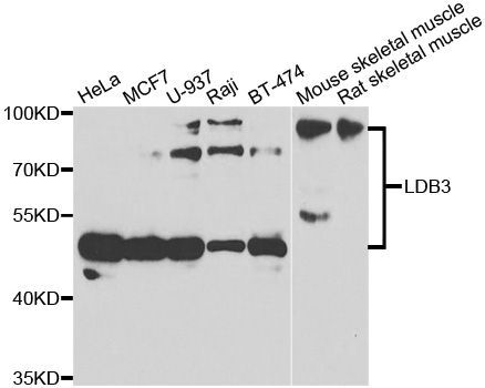 Western blot - LDB3 antibody (144-07462)