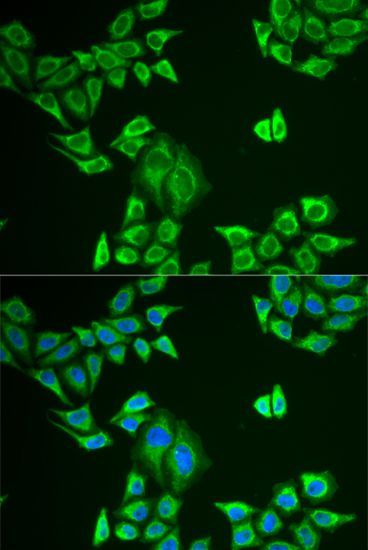 Immunofluorescence - MLANA Polyclonal Antibody (144-06290)