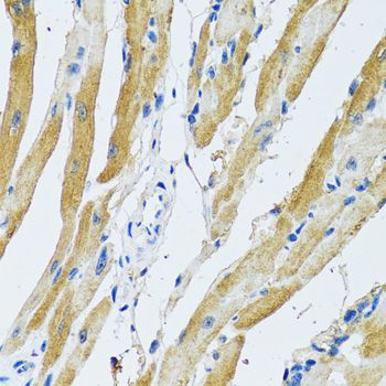 Immunohistochemistry - GDAP1 antibody (144-06601)