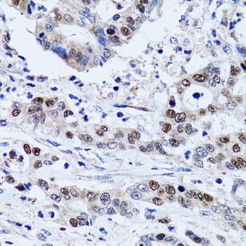 Immunohistochemistry - UHRF1 antibody (144-02343)