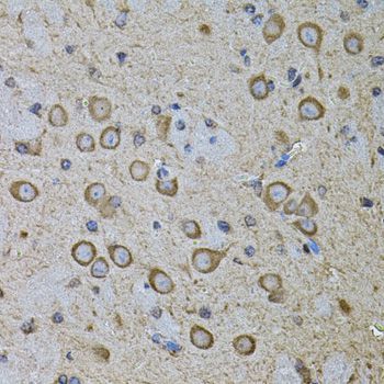 Immunohistochemistry - CDH16 antibody (144-07882)