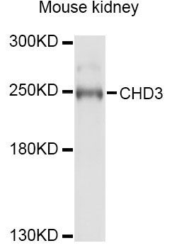 Western blot - CHD3 Polyclonal Antibody (144-02221)