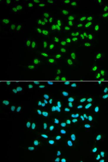 Immunofluorescence - FANCD2 Polyclonal Antibody (144-02072)