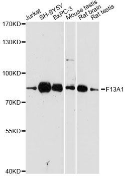 Western blot - F13A1 antibody (144-60725)
