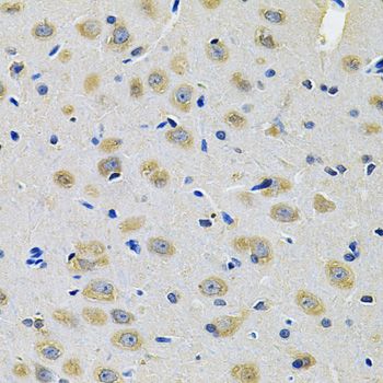 Immunohistochemistry - TXNDC5 Antibody (144-014152)