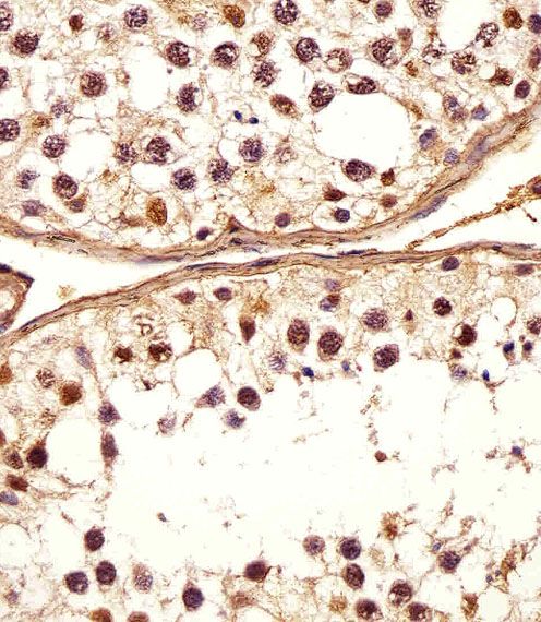 IHC-P