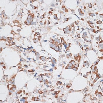 Immunohistochemistry - KIF14 Polyclonal Antibody (144-10275)