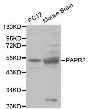 Western blot - PARK2 Polyclonal Antibody (144-00968)