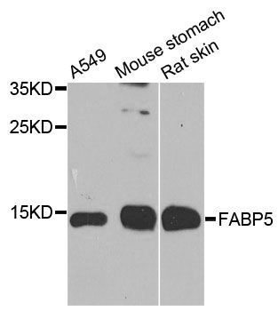 Western blot - FABP5 Polyclonal Antibody (144-00947)