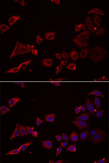 Immunofluorescence - NRBF2 antibody (144-06462)