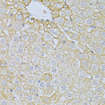 Immunohistochemistry - PLA2R1 Polyclonal Antibody (144-10068)