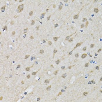Immunohistochemistry - XRCC3 antibody (144-02134)