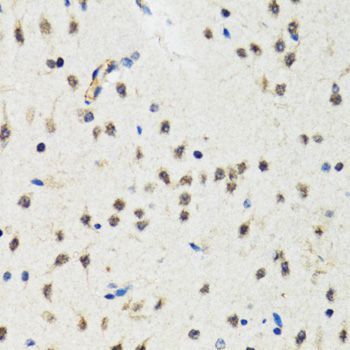Immunohistochemistry - CHUK Polyclonal Antibody (144-02062)