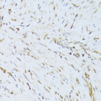 Immunohistochemistry - [KO Validated] AIFM1 Polyclonal Antibody (144-02568)