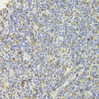 Immunohistochemistry - CD74 Antibody (144-05667)