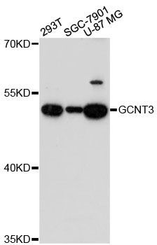 Western blot - GCNT3 antibody (144-60239)