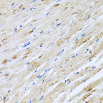Immunohistochemistry - STRN antibody (144-07734)