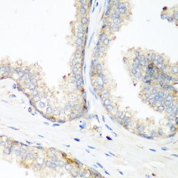 Immunohistochemistry - NEDD4 Polyclonal Antibody (144-00552)