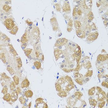 Immunohistochemistry - HDAC4 Polyclonal Antibody (144-00179)