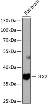 Western blot