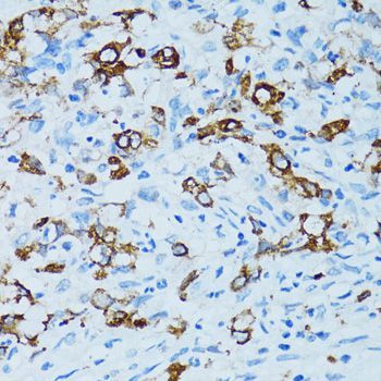 Immunohistochemistry - CTSE antibody (144-02678)
