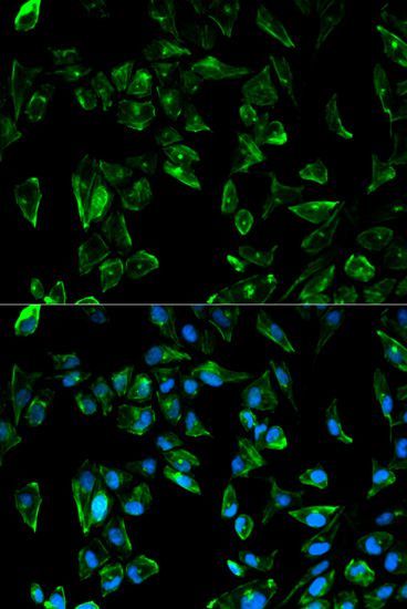Immunofluorescence - TPM3 antibody (144-01206)