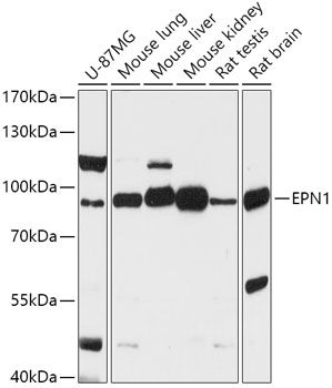 Western blot