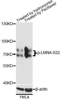 Western blot - Phospho-LMNA-S22 pAb (144-61515)