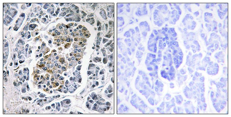 IHC